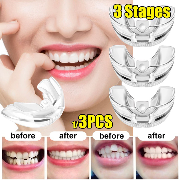 Xpreen Mouth Guard,Braces Invisible 3 Stages Tooth Appliance Aligners Trays Teeth Straightener Retainer Alignment Trainer Mouth