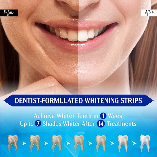 Teeth Whitening Strips, Xpreen Professional White Strips Teeth Whitener for Tooth Whitening, 28Pcs