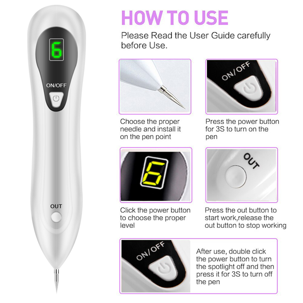 Xpreen Mole Remover Pen, Skin Tag Remover Dark Spot Remover Freckle Tattoo Wart Mole Removal Tool with LCD Screen and Spotlight